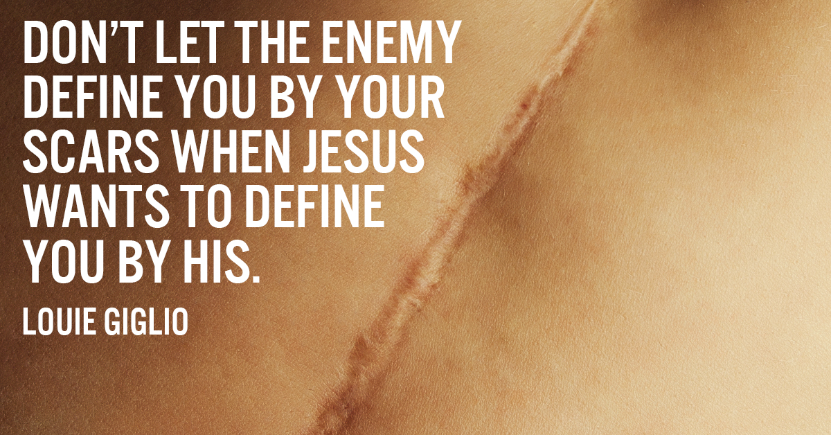 Don't let the enemy define you by your scars when Jesus wants to define